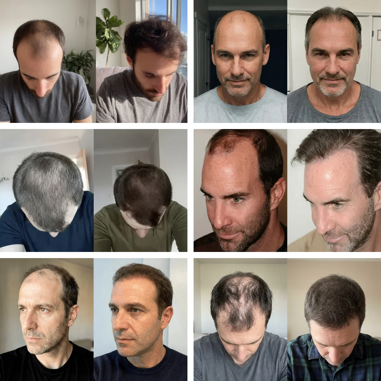 Before and after results from men using the Ultimate Man Spray